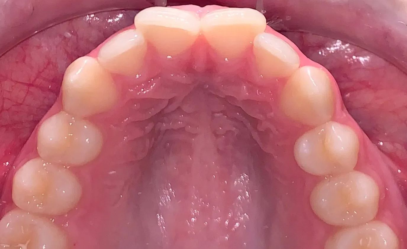 A close up of a man 's teeth with a beard.