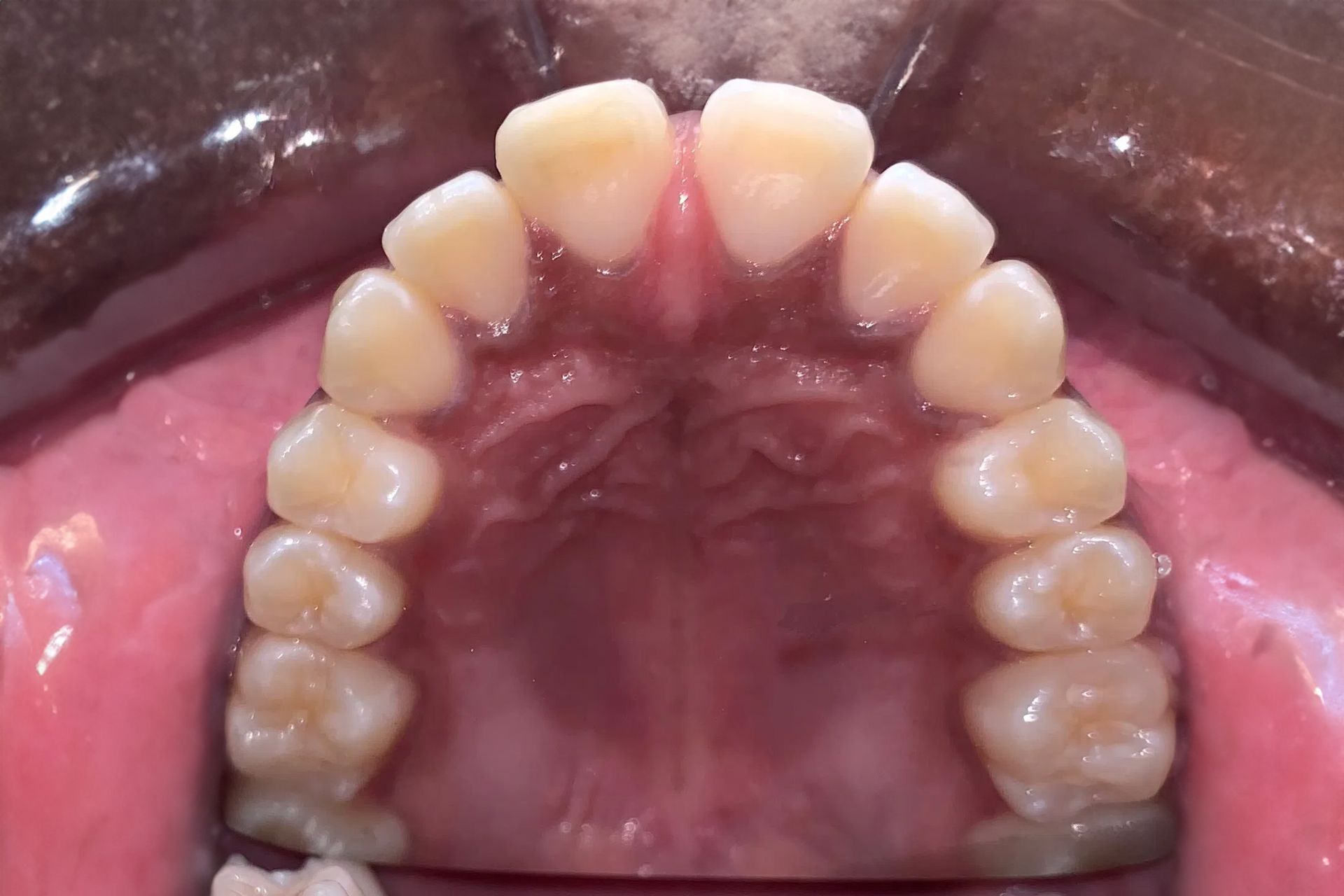 A close up of a man 's teeth with a beard.