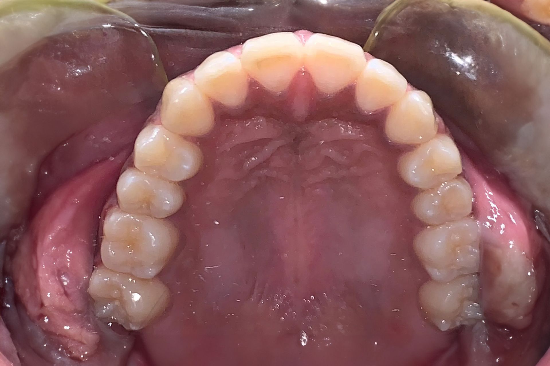 A close up of a man 's teeth with a beard.