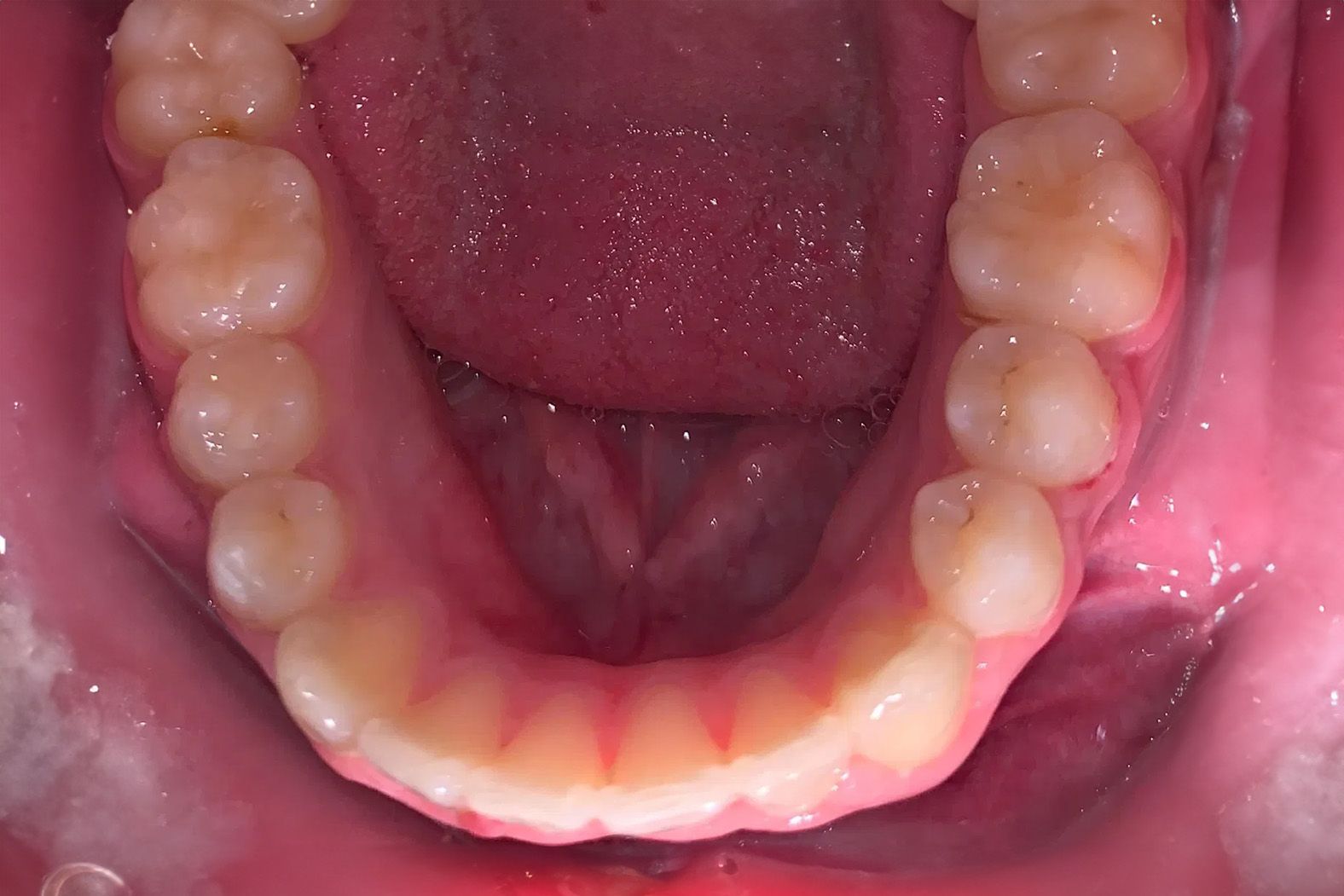 A close up of a man 's teeth with a beard.
