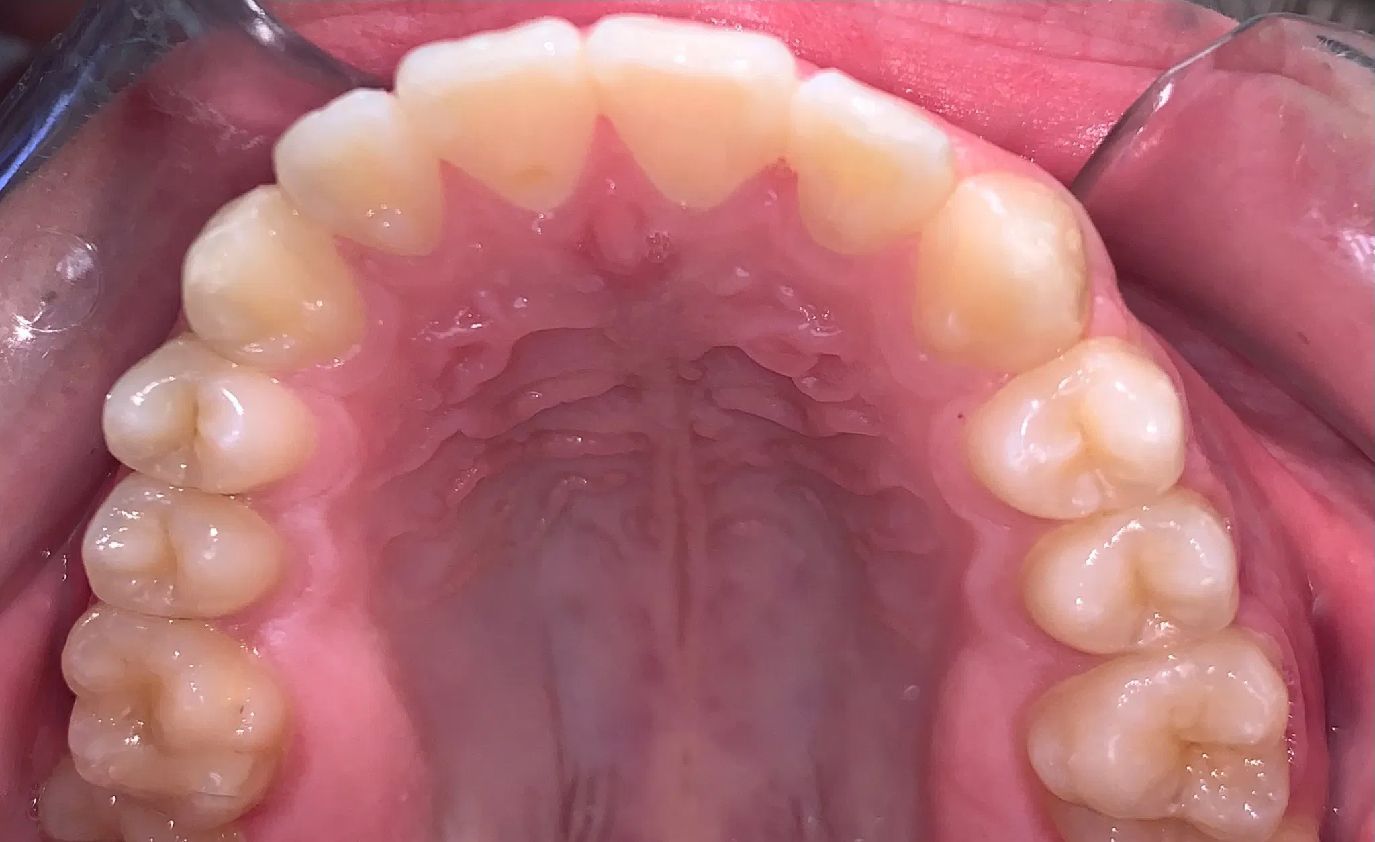 A close up of a man 's teeth with a beard.