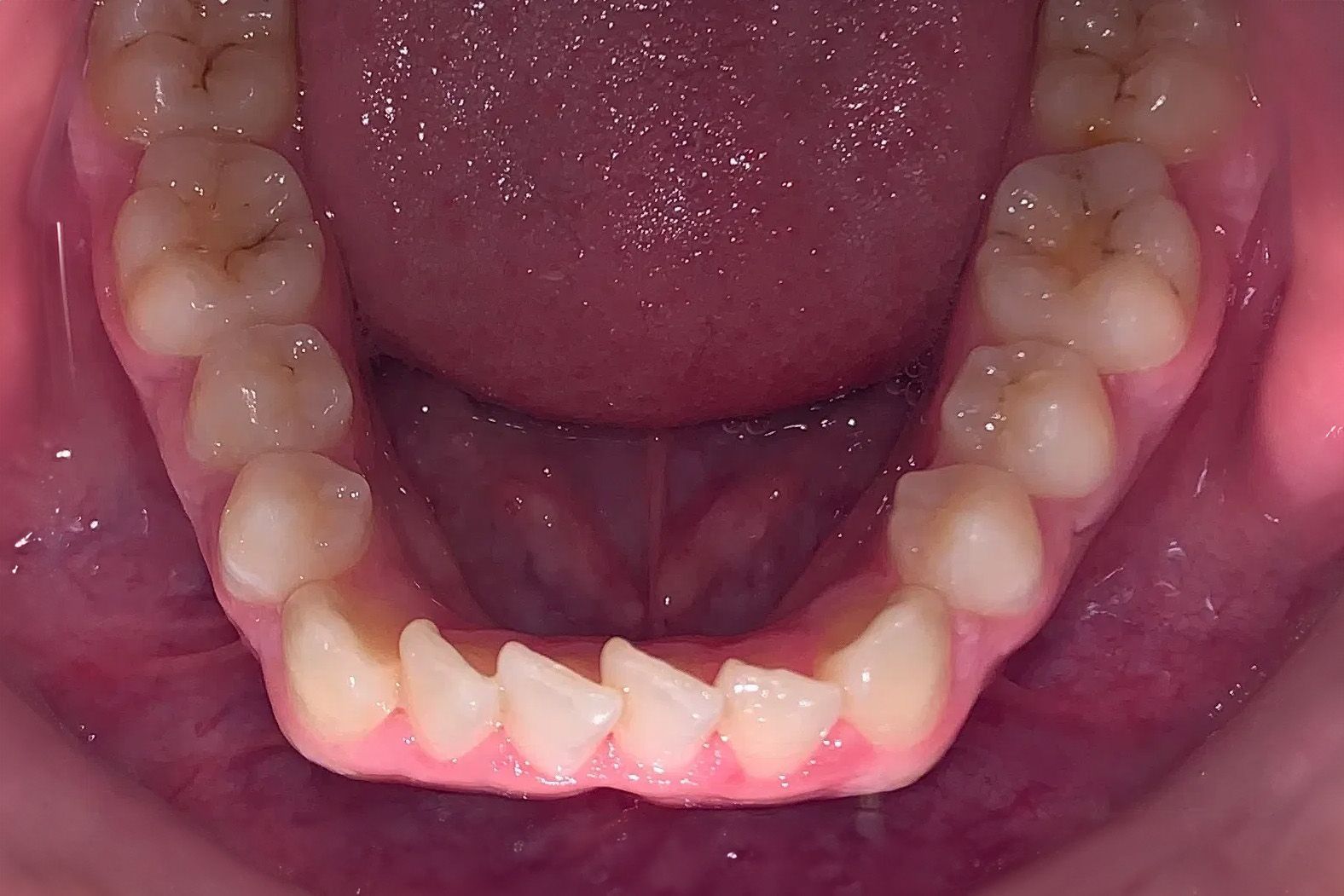 A close up of a man 's teeth with a beard.