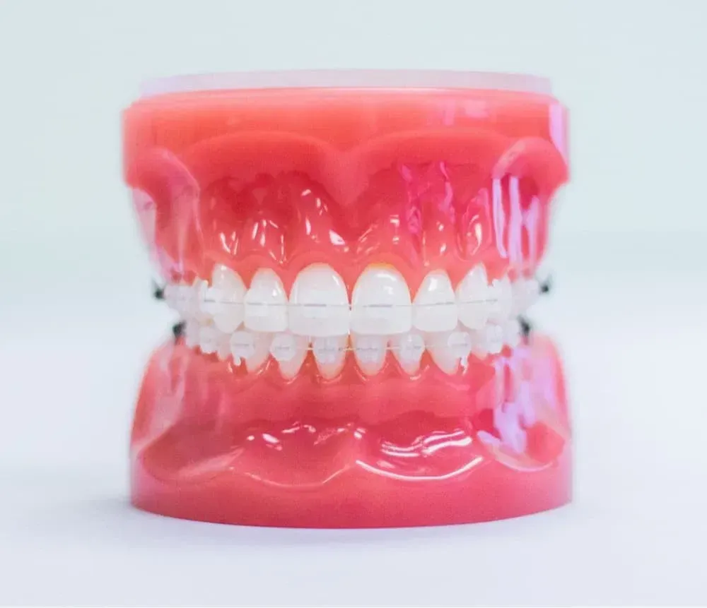 Model of teeth with clear braces on a pink gum base, displayed on a white surface.