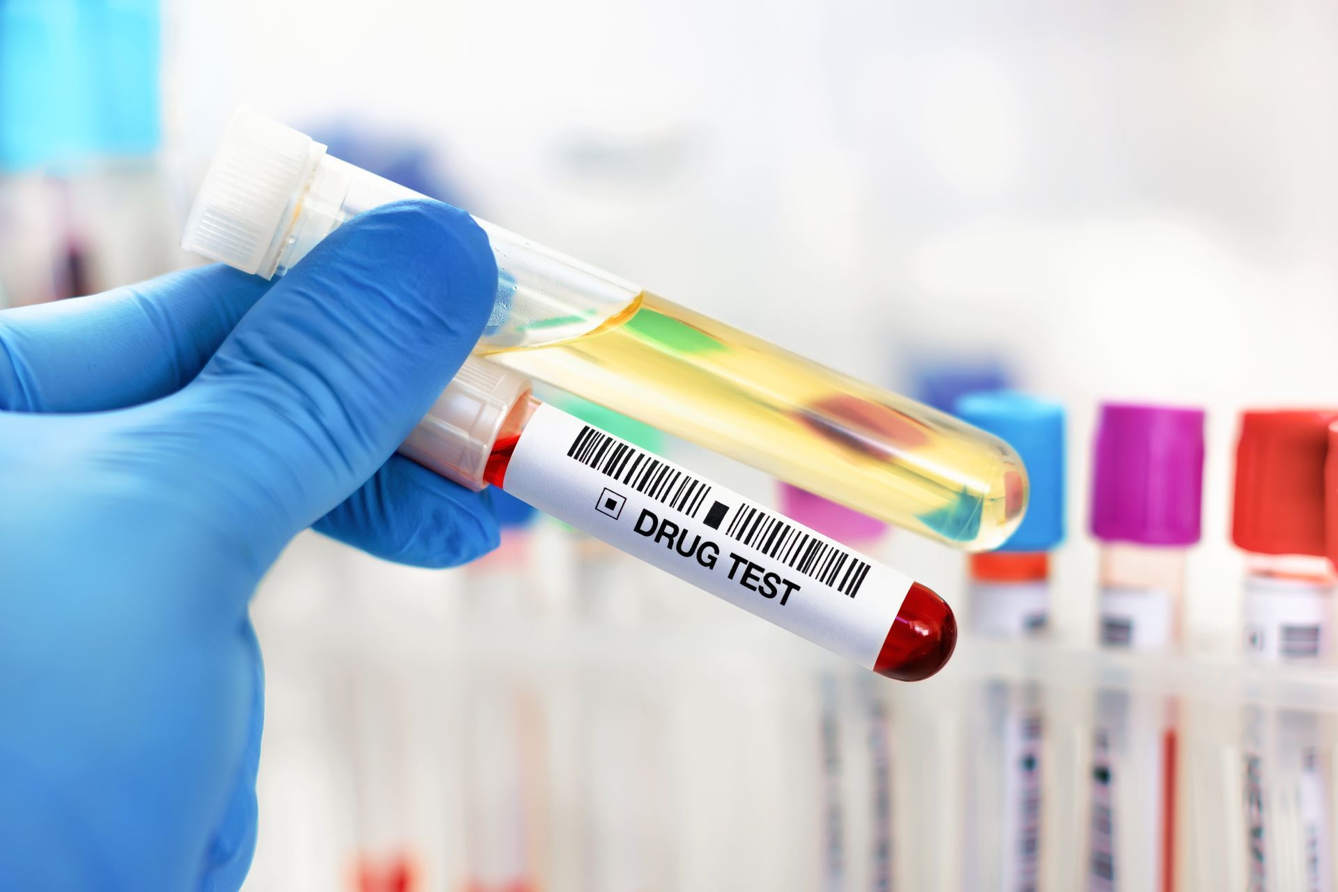 Gloved hand holding a labeled drug test urine sample vial beside blurred test tubes