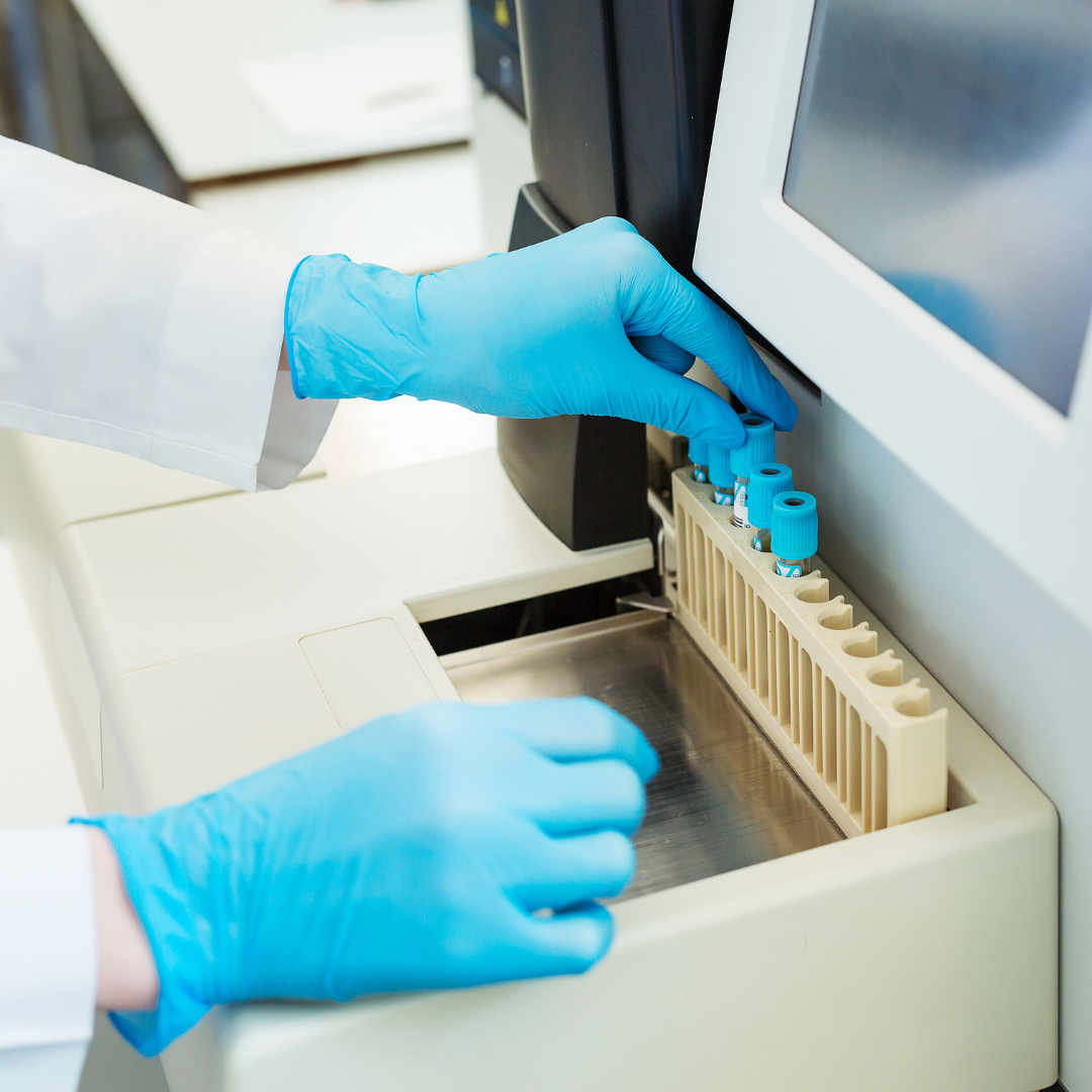 Una persona que lleva guantes azules está trabajando en una máquina.