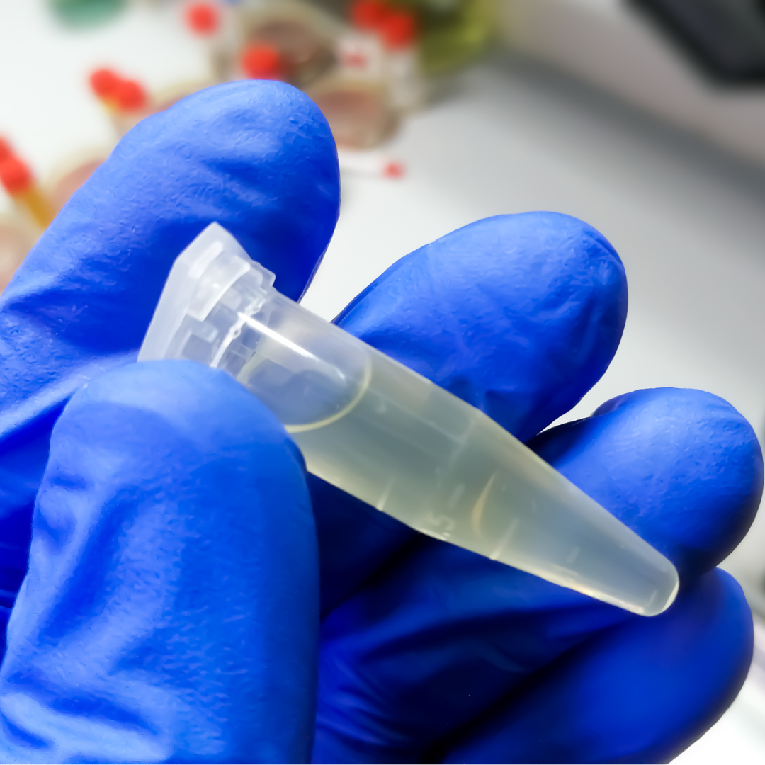 Alergias e Intolerancia