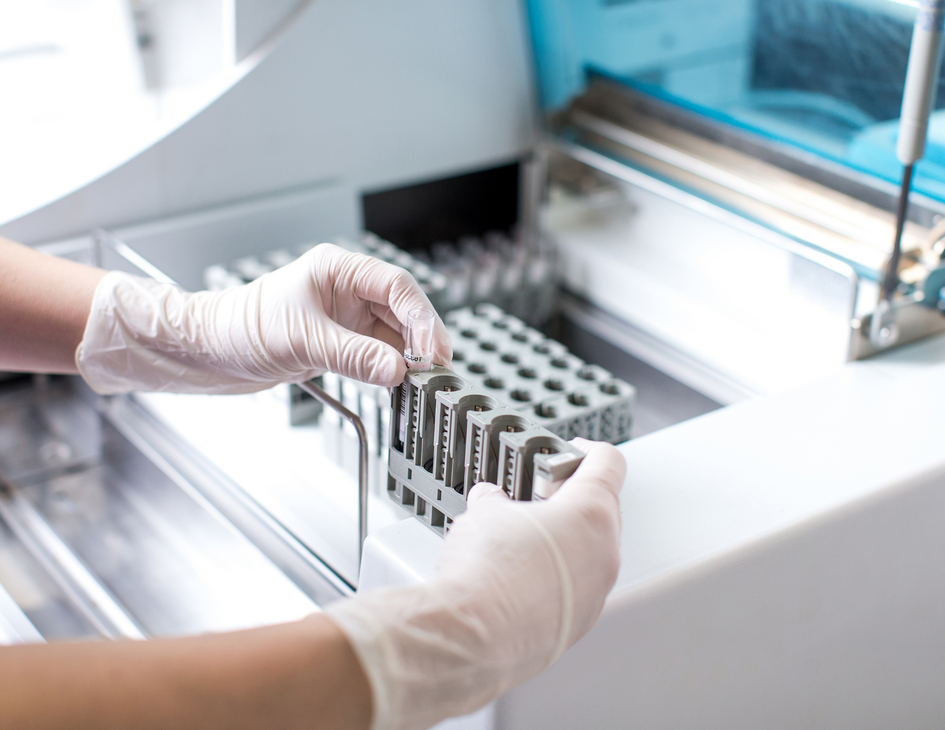 Una persona que lleva guantes sostiene un tubo de ensayo en un laboratorio.