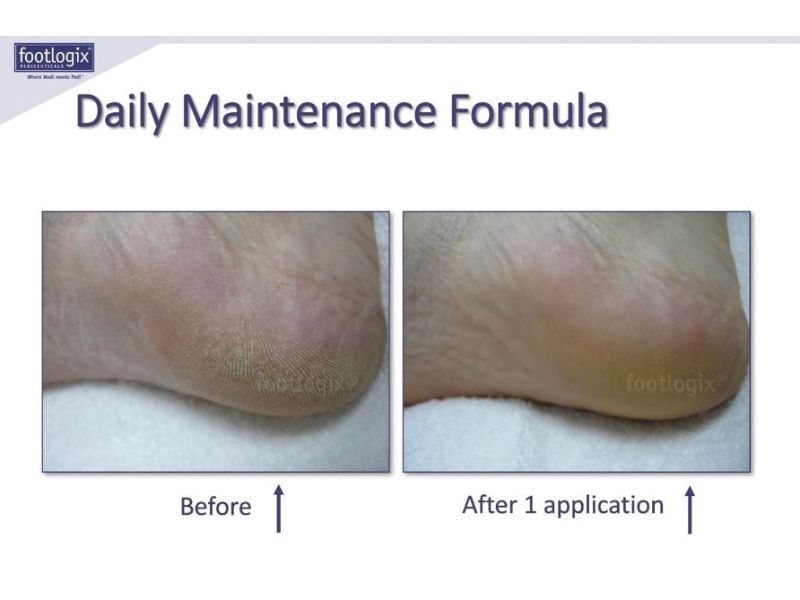 before and after view of daily maintenance formula