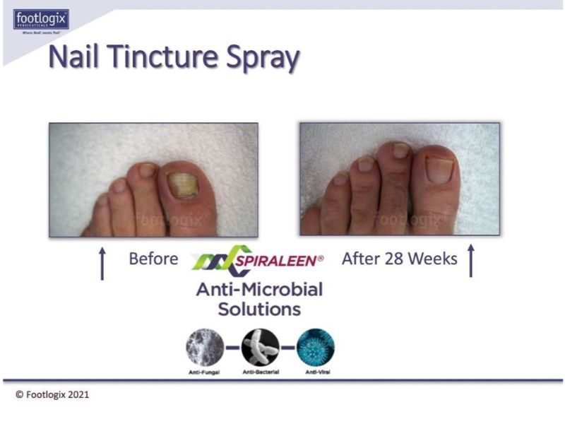 before and after results view of nail tincture spray