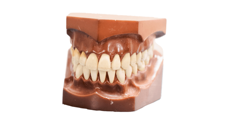 A close up of a model of a person 's teeth on a white background.