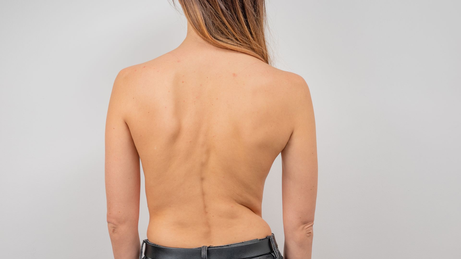 The back of a woman without a shirt is shown.