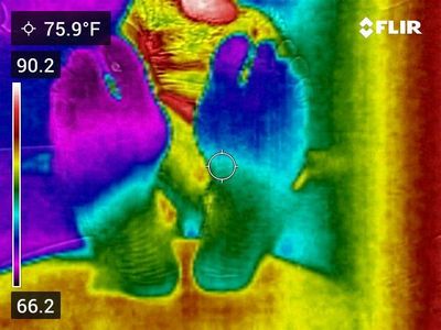 feet with neuropathy