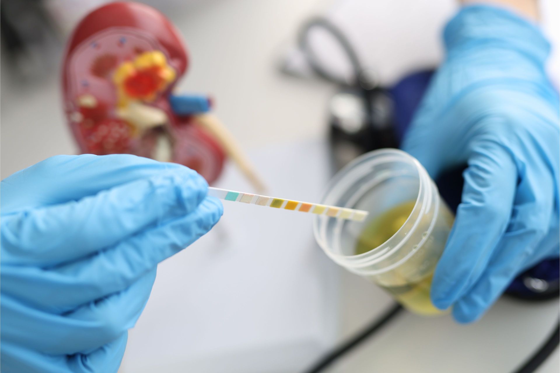 Hands in blue gloves holding a urine dipstick and container, next to a kidney model.