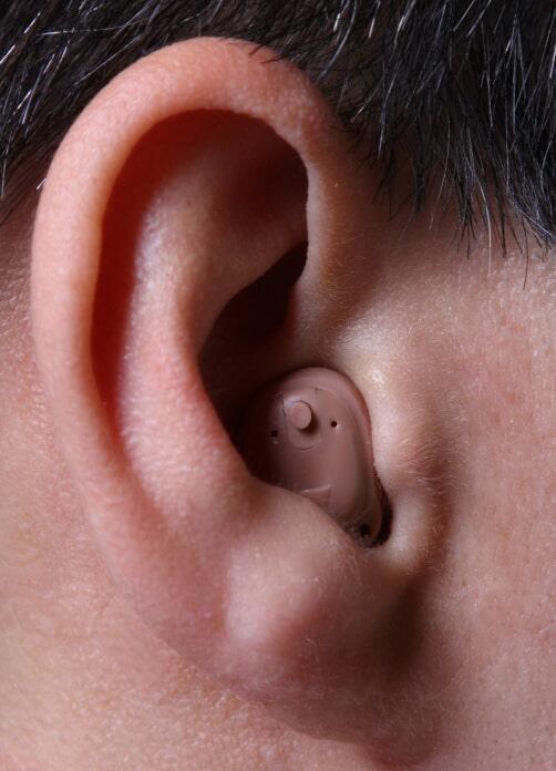 APARATOS AUDITIVOS XALAPA