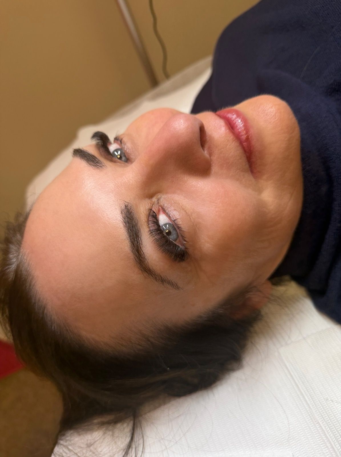 Woman with dark eyebrows and lip color, lying down, possibly after a cosmetic procedure.