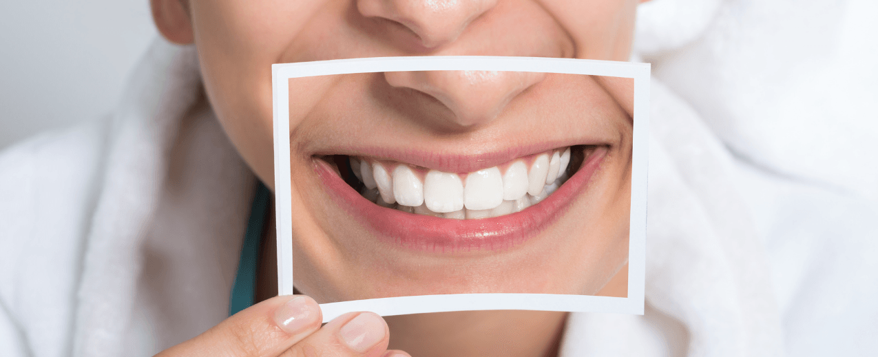 woman smiling holding up a pictures | family dentist in lawson and Richmond mo | Teeth Whitening