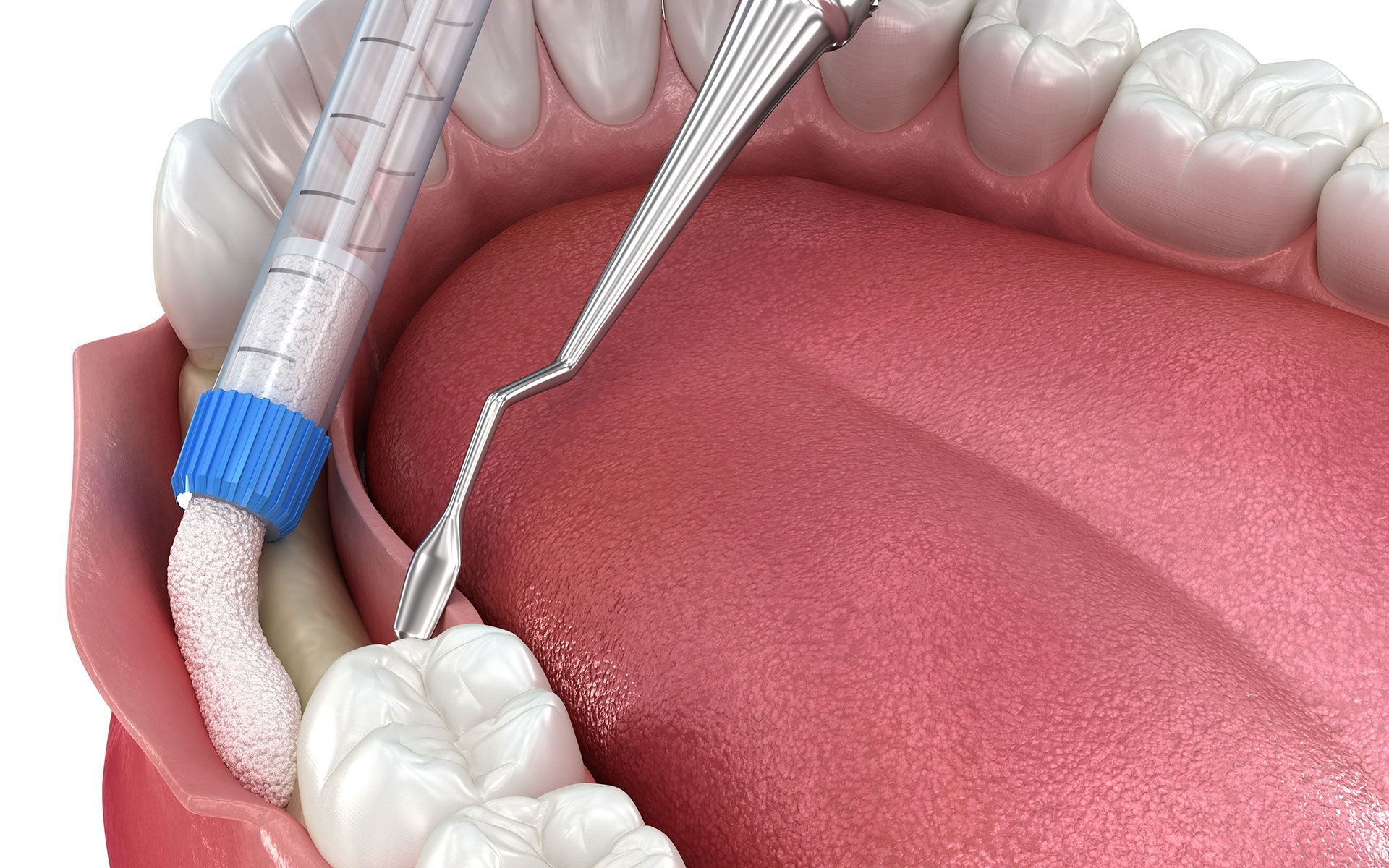 A close up of a person 's mouth with a syringe in it.