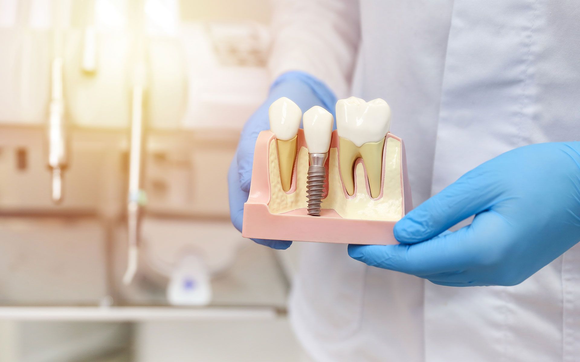 A dentist is holding a model of a dental implant.