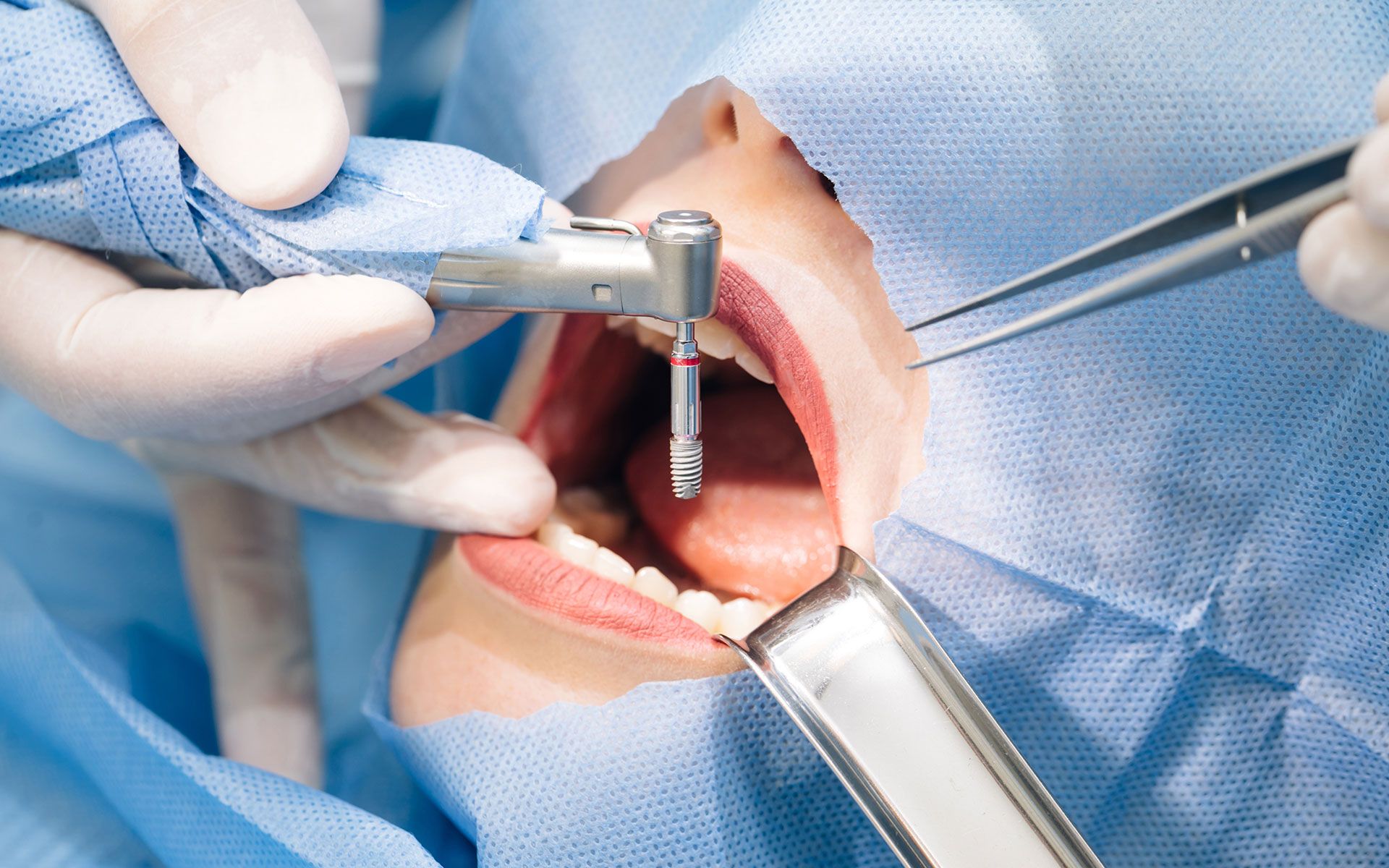 A dentist is working on a patient 's teeth with a drill.