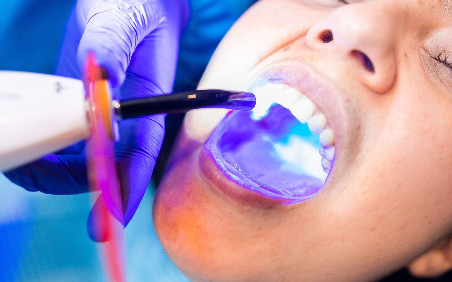 A woman is getting her teeth whitened by a dentist.