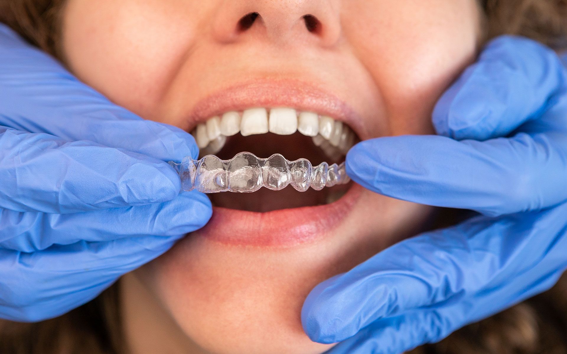 A woman is getting her teeth straightened by a dentist.