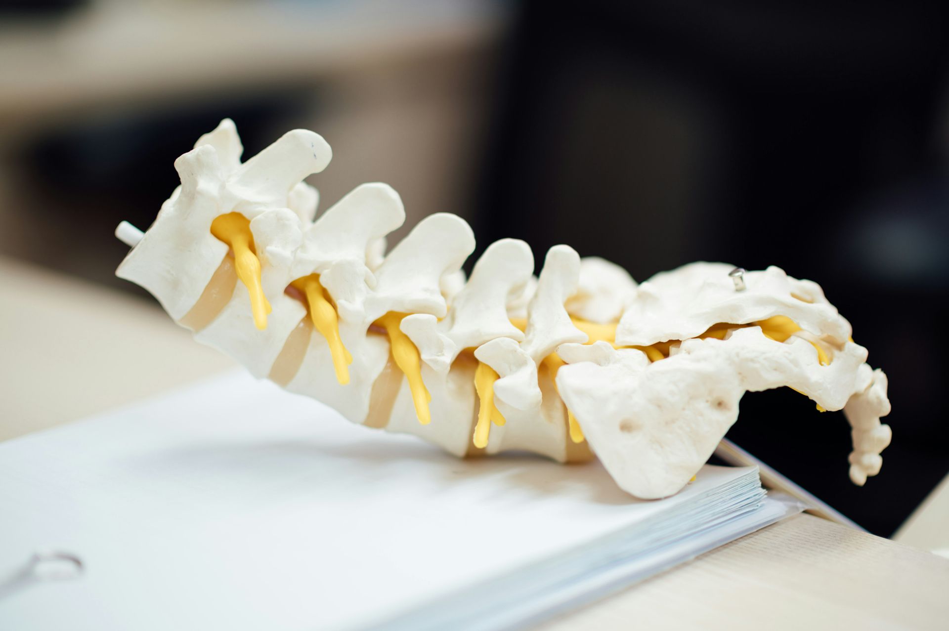 A model of a human lumbar spine and sacrum with yellow intervertebral discs resting on a white surface.