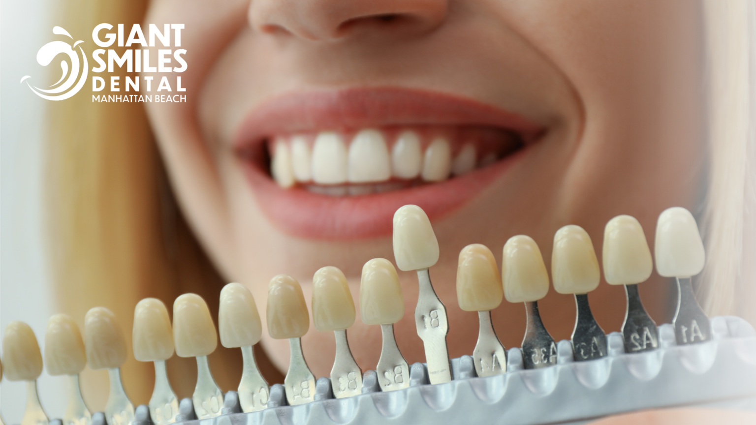 A woman is holding a palette of teeth colors in front of her mouth.