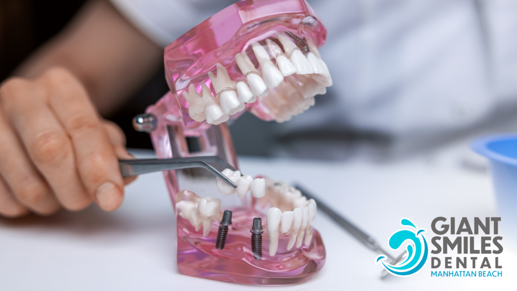 A person is holding a model of a person 's teeth.