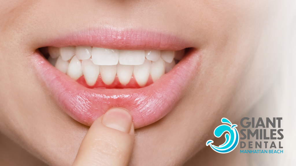 A close up of a woman 's mouth with a finger pointing to her teeth.