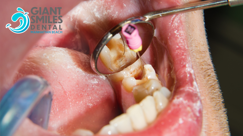 A person is getting their teeth examined by a dentist.