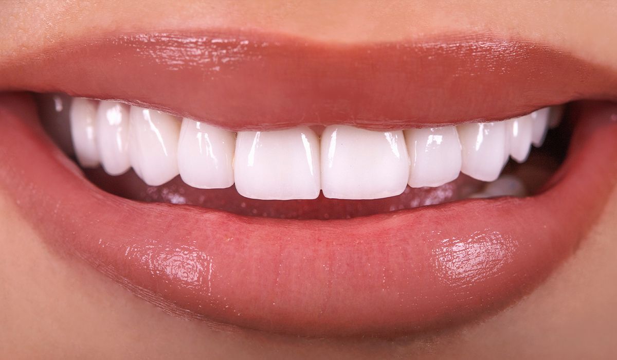 A close up of a woman 's smile with white teeth.