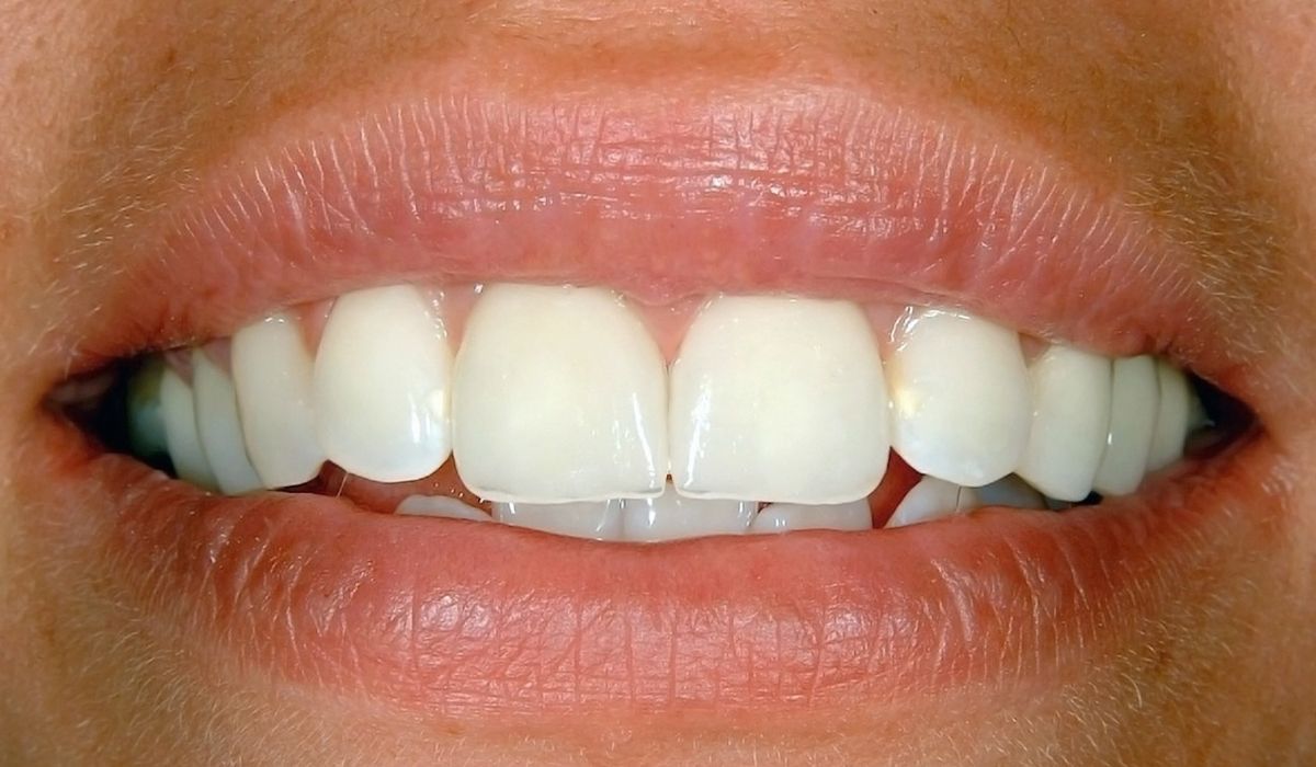 A close up of a woman 's mouth with white teeth.