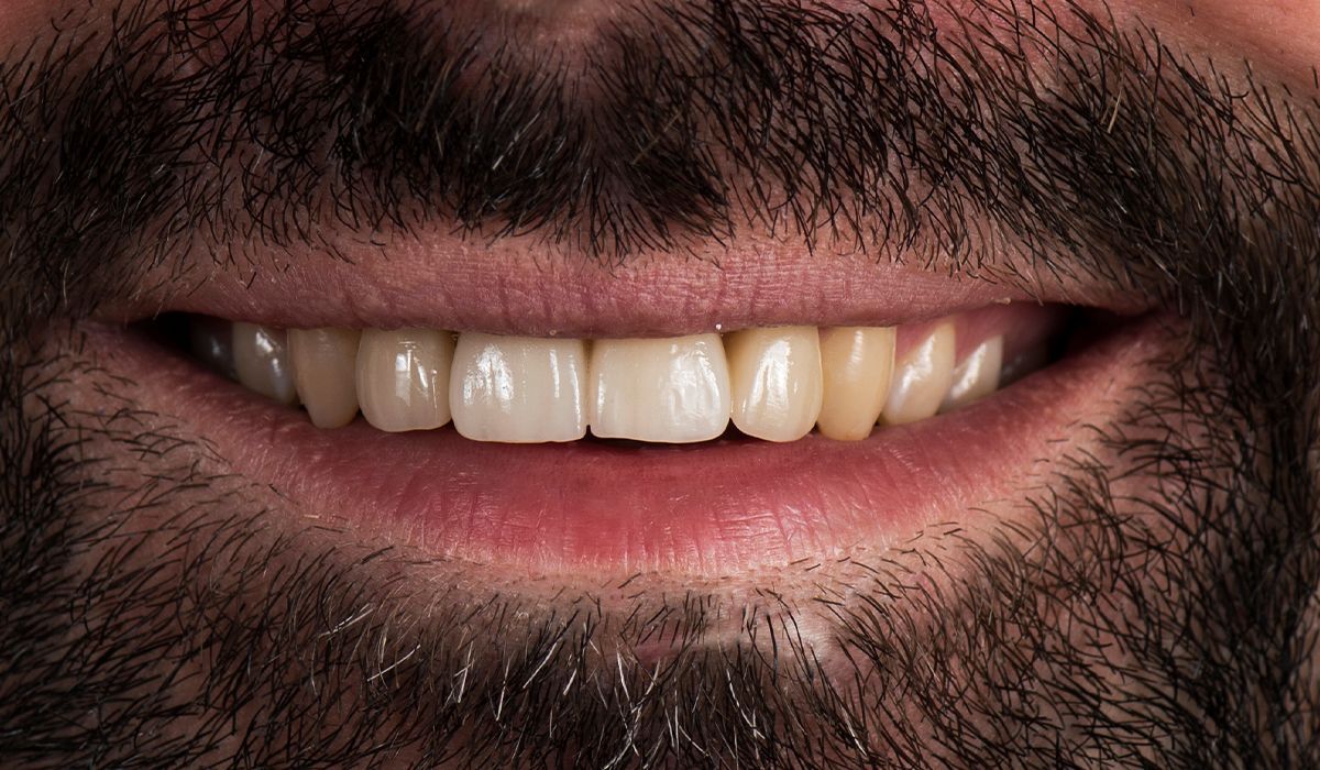 A close up of a man 's mouth with a beard and teeth.