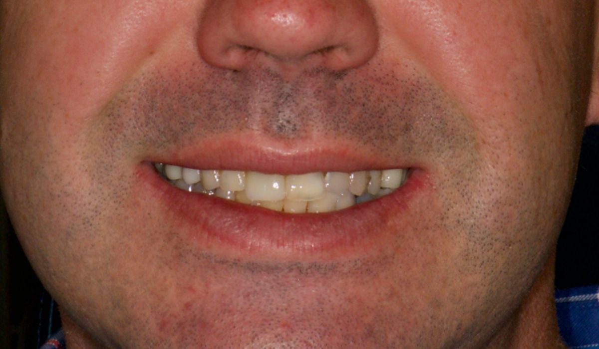 A close up of a man 's face with a smile on his face.