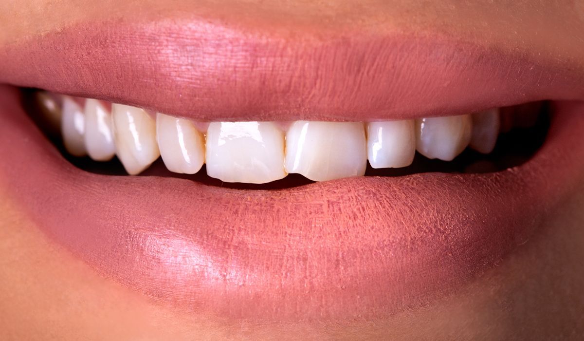 A close up of a person 's mouth with white teeth and pink lips.