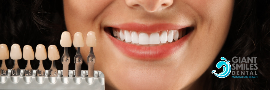 Woman smiling with bright white teeth, teeth shade guide, and 