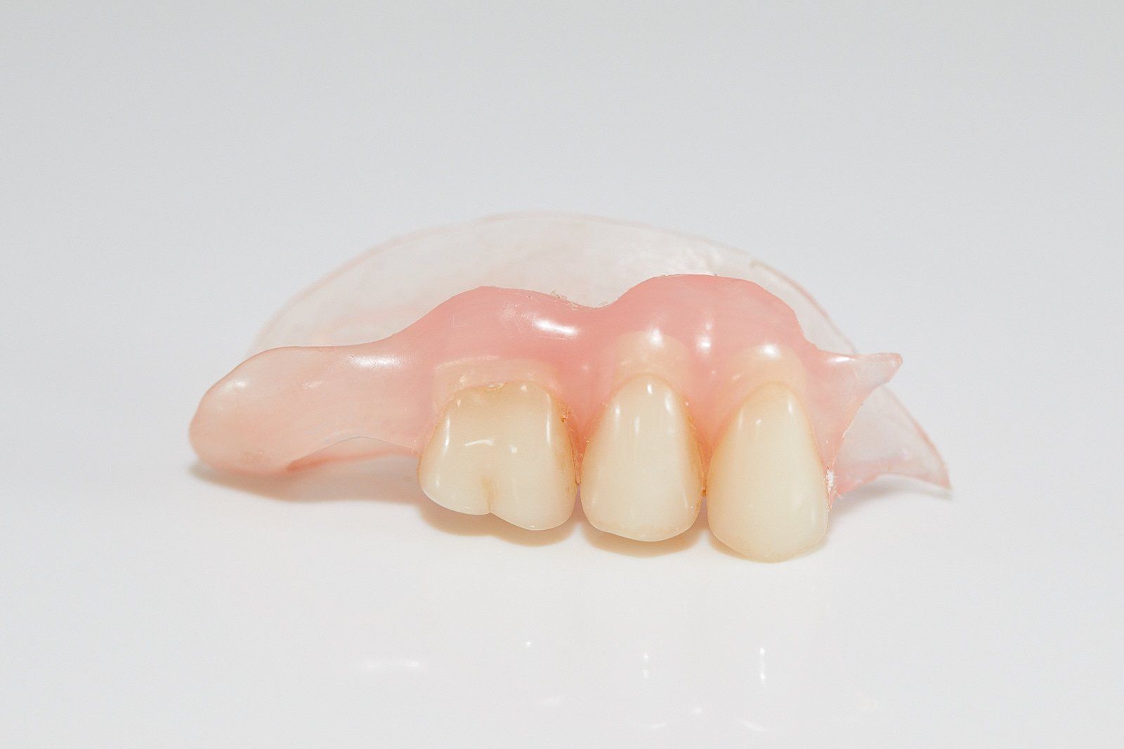 Implant Retained Partial Denture — Bromley's Denture Clinic in Tweed Heads South, NSW