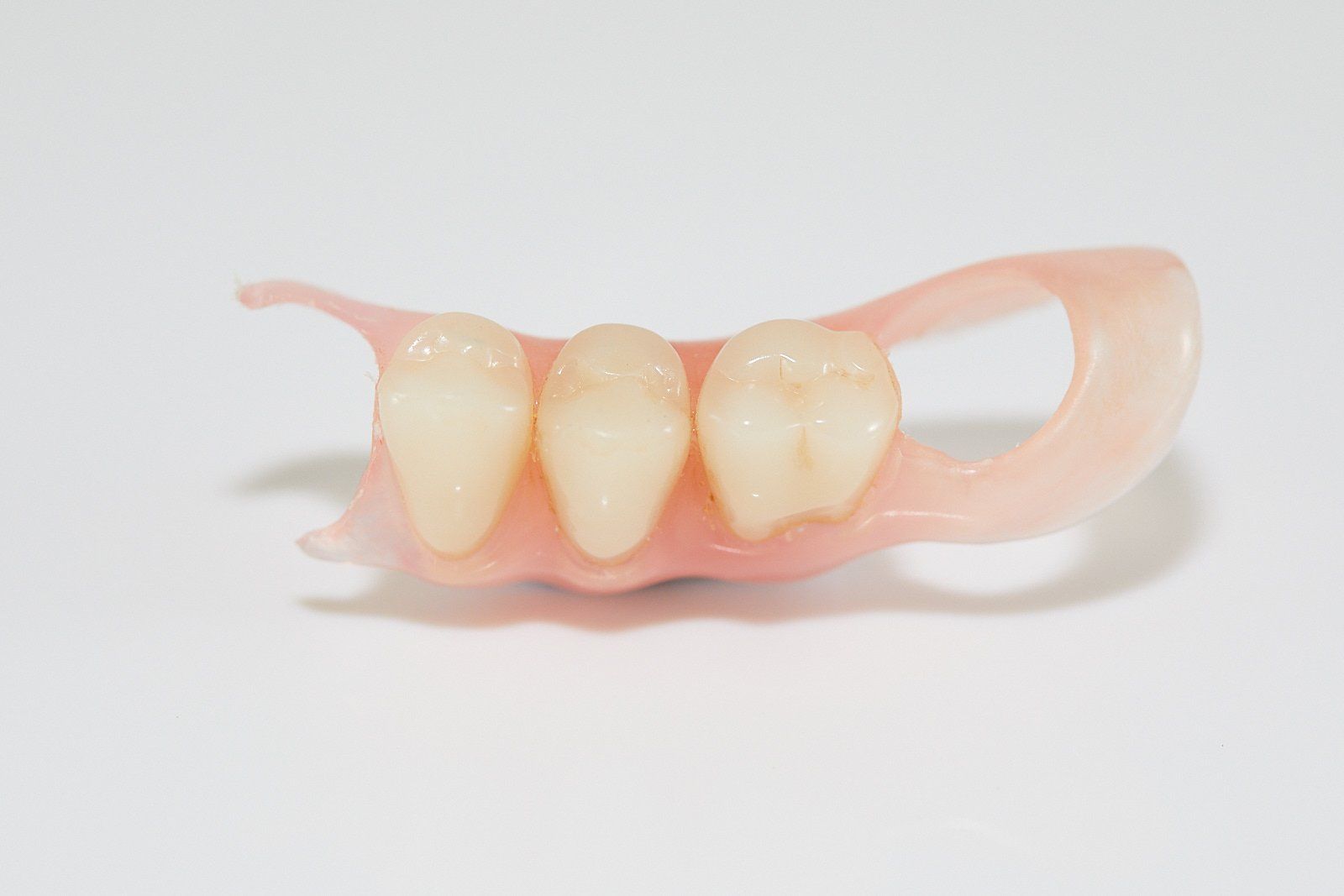 Partial Denture — Bromley's Denture Clinic in Tweed Heads South, NSW