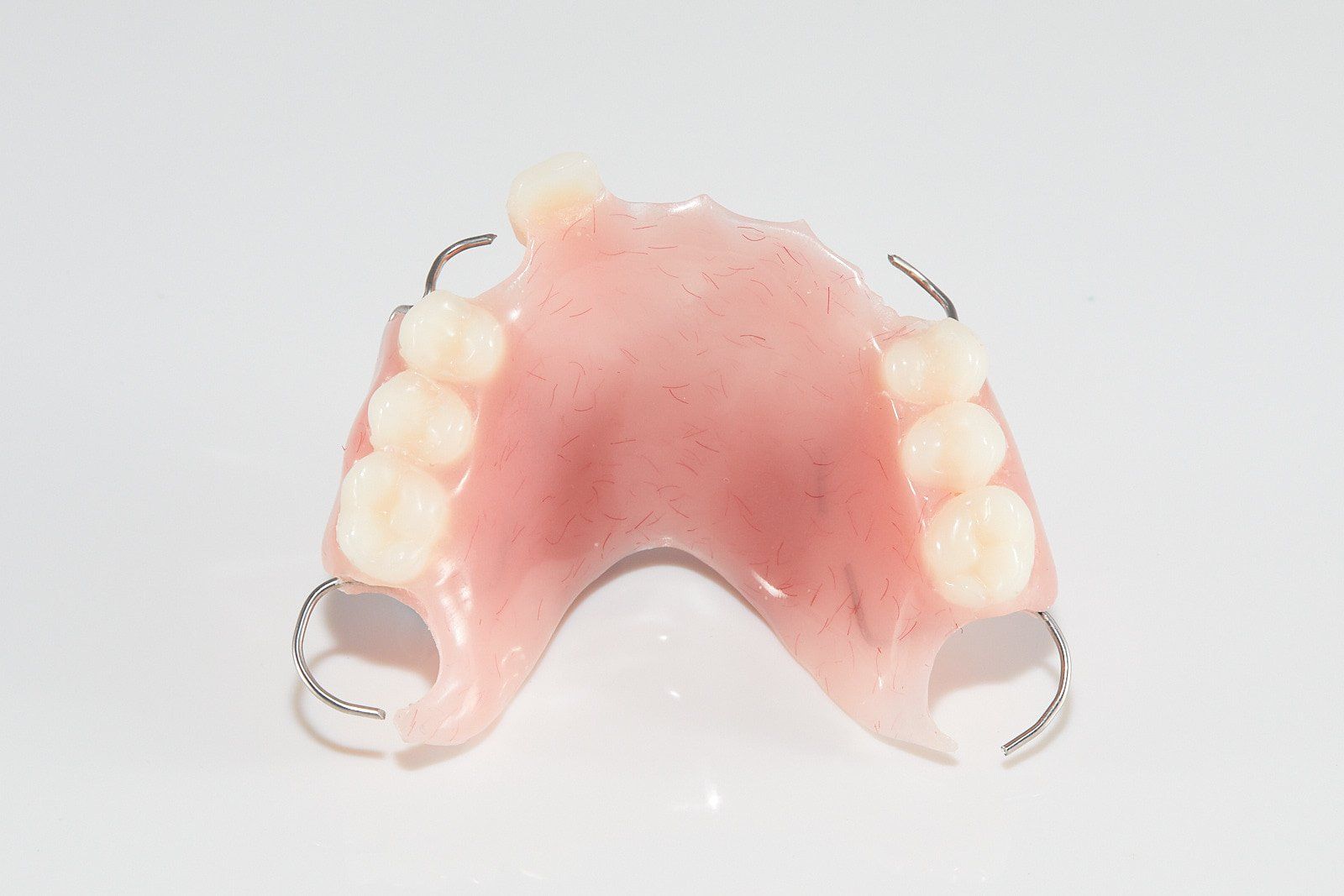 Partial Denture — Bromley's Denture Clinic in Tweed Heads South, NSW