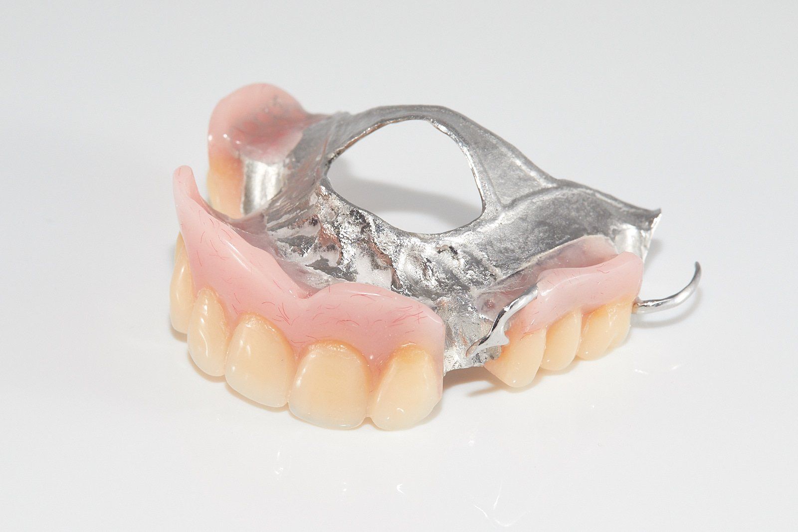 Implant Retained Denture — Bromley's Denture Clinic in Tweed Heads South, NSW