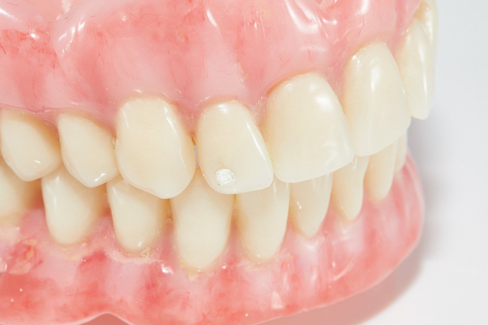 Full Set of Dentures — Bromley's Denture Clinic in Tweed Heads South, NSW