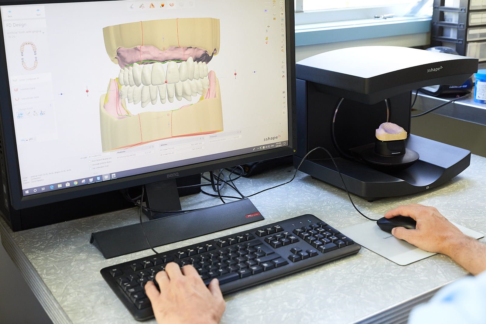 Designing Denture on Computer — Bromley's Denture Clinic in Tweed Heads South, NSW