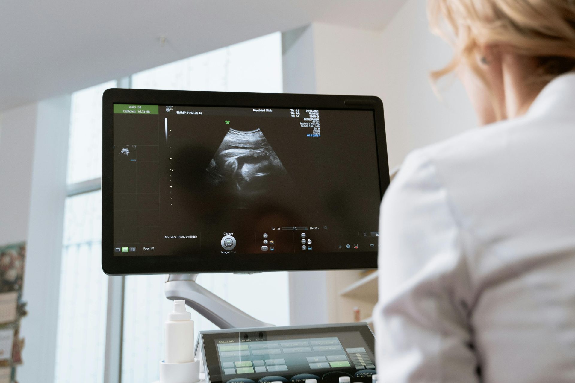 A woman is looking at an ultrasound on a computer screen.