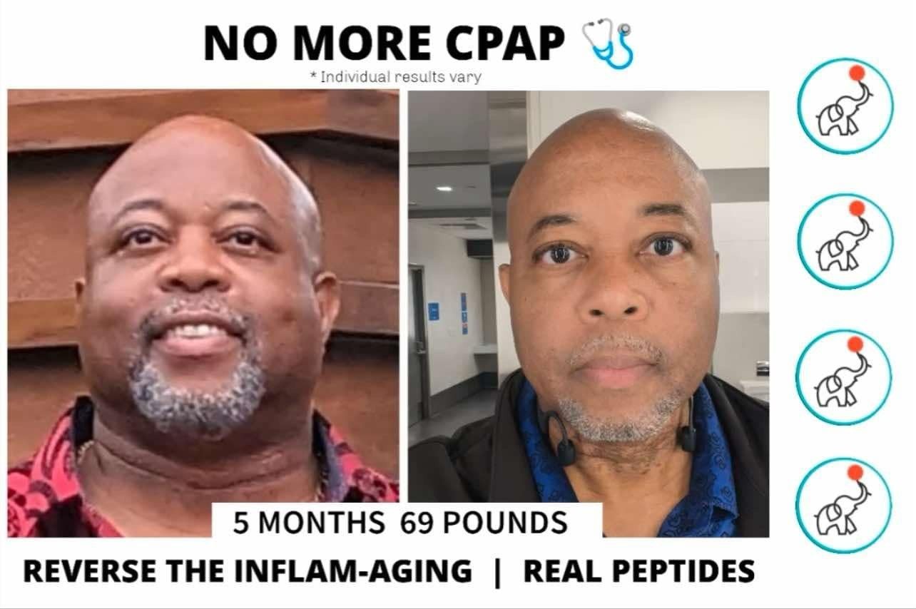 Before-and-after comparison of a man. Lost 69 pounds in 5 months, no longer needs CPAP. Promotes peptide treatment.