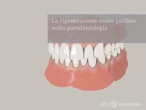 Rigenerazione guidata