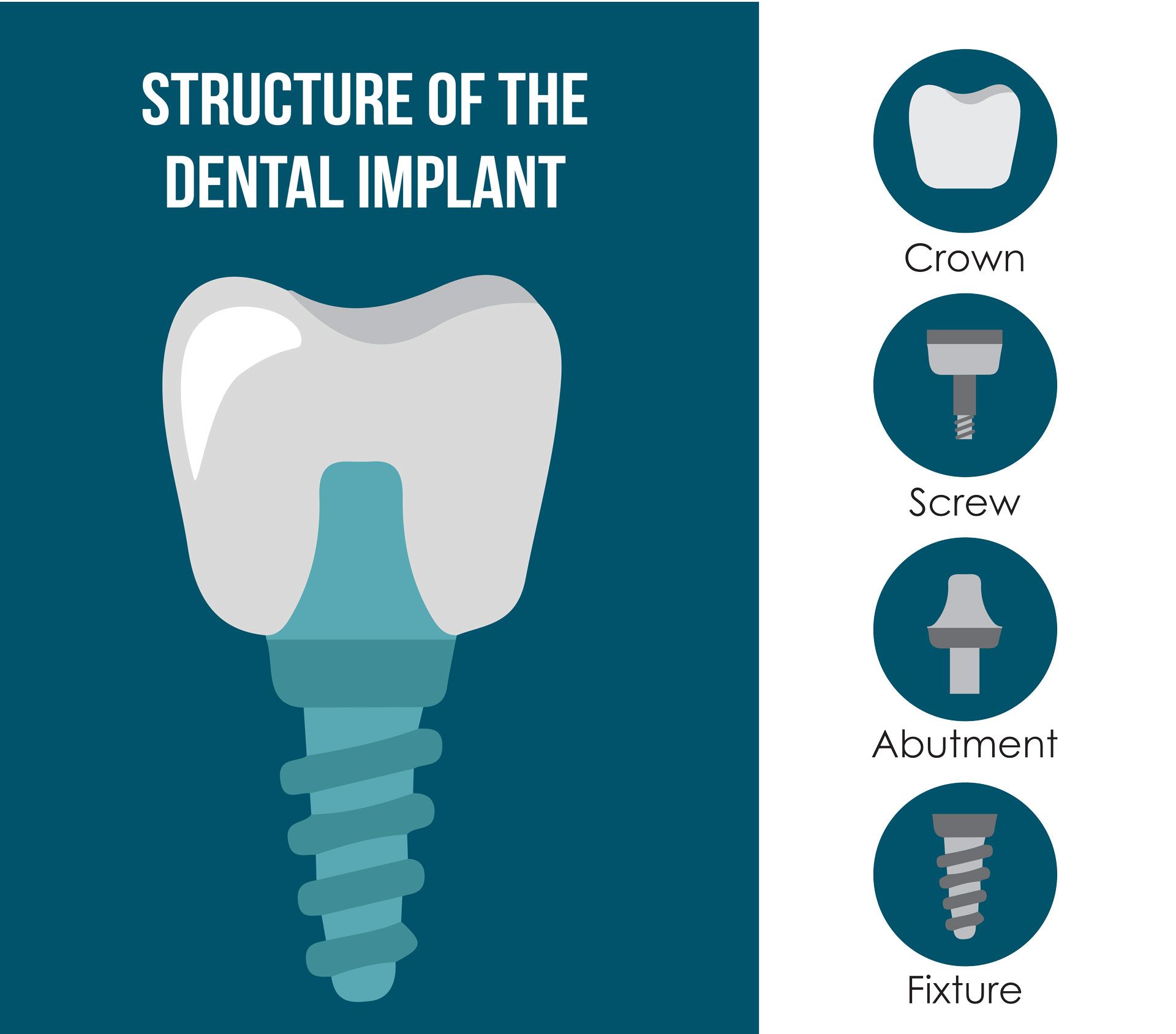 Dental Implants — Nowra NSW — Amazing Dental