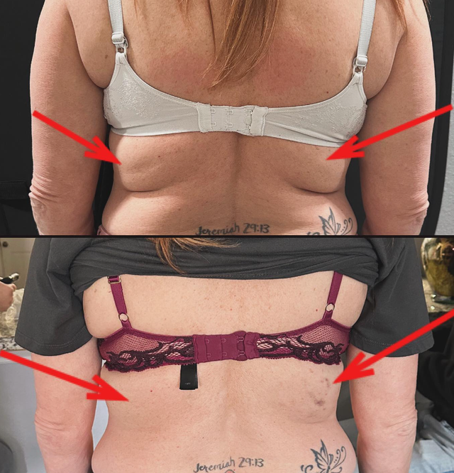 glp 1 effect on libido Are GLP-1 weight loss drugs affecting your sex life? 😒 In a Kinsey  Institute study, 52% of people said 