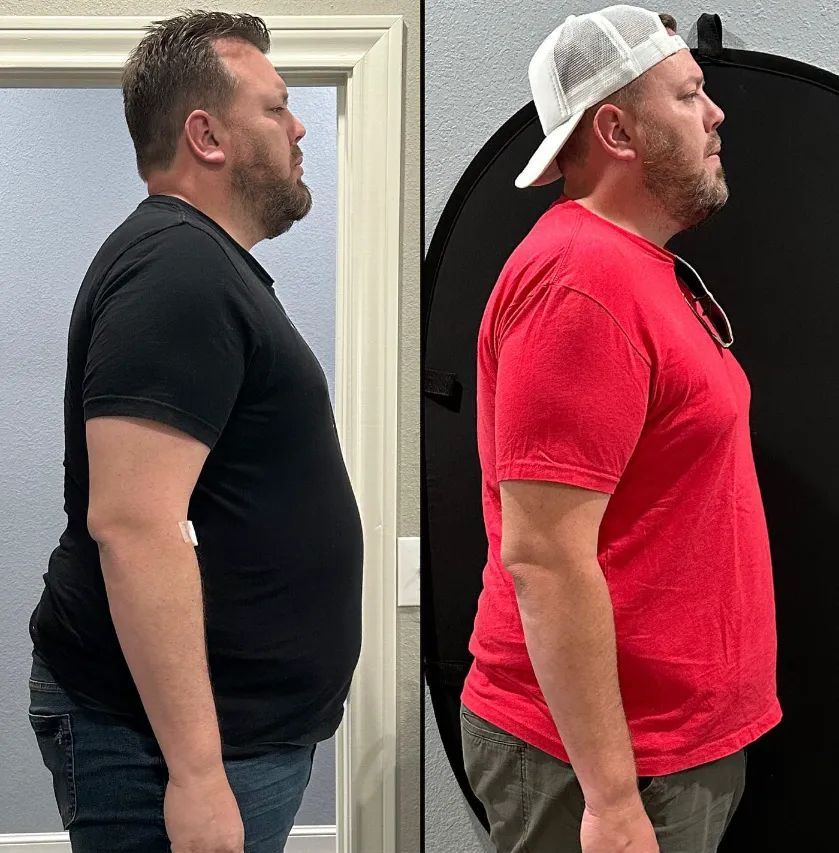 Side-by-side comparison of a man, before and after a change. Shows a reduction in body size; he wears black shirt then red.