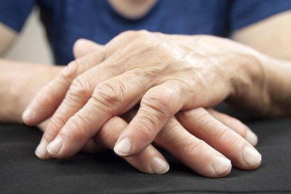 Elderly person with arthritis in hands