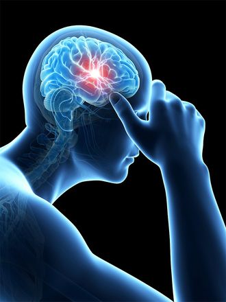 3D image of person with headache pain
